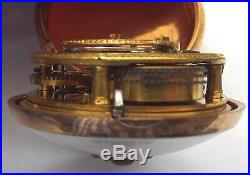 Rare Mint Triple Case Under Painted Horn Doctors Watch Verge Fusee Working